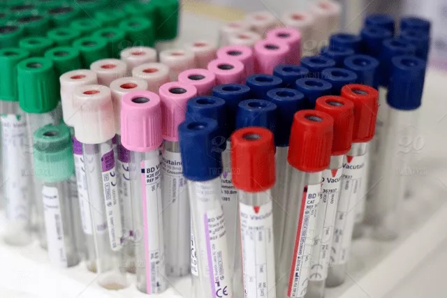 Representation of pathology concept by Assorted blood tubes in a row, each with a different color, Assorted blood tubes in a row, each with a different color, representing a Pathology Homework Help concept