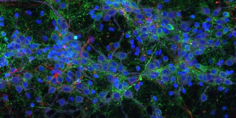 Computational Biology Visualization for assignment help a close up of a cell phone with many different colours indicating the concept of computational biology assignment help