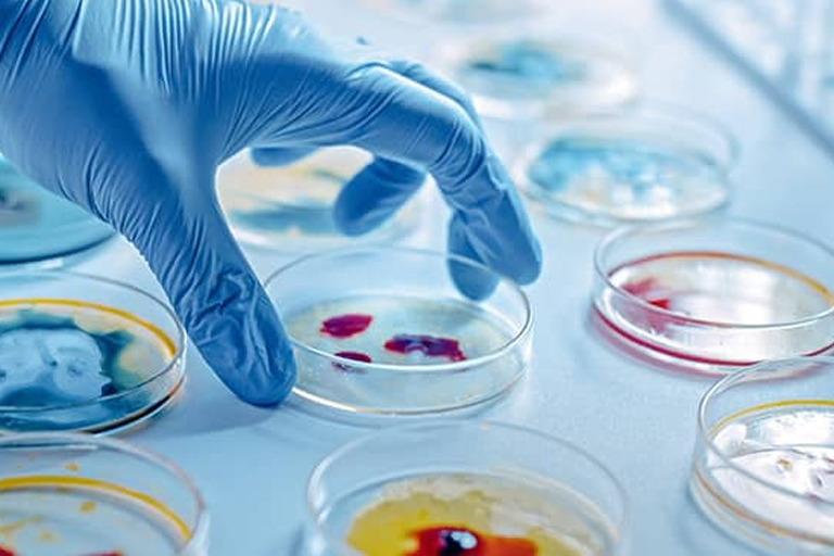 Exploring Microbial Mysteries: a microbiology student investigates contents of a petri dish as a part of microbiology assignment help In a microbiology lab, a student in blue gloves investigates contents of a petri dish as a part of his microbiology assignment help